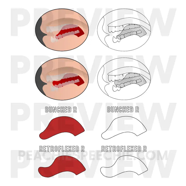 Speech Sound Clipart - Materials peachiespeechie.com