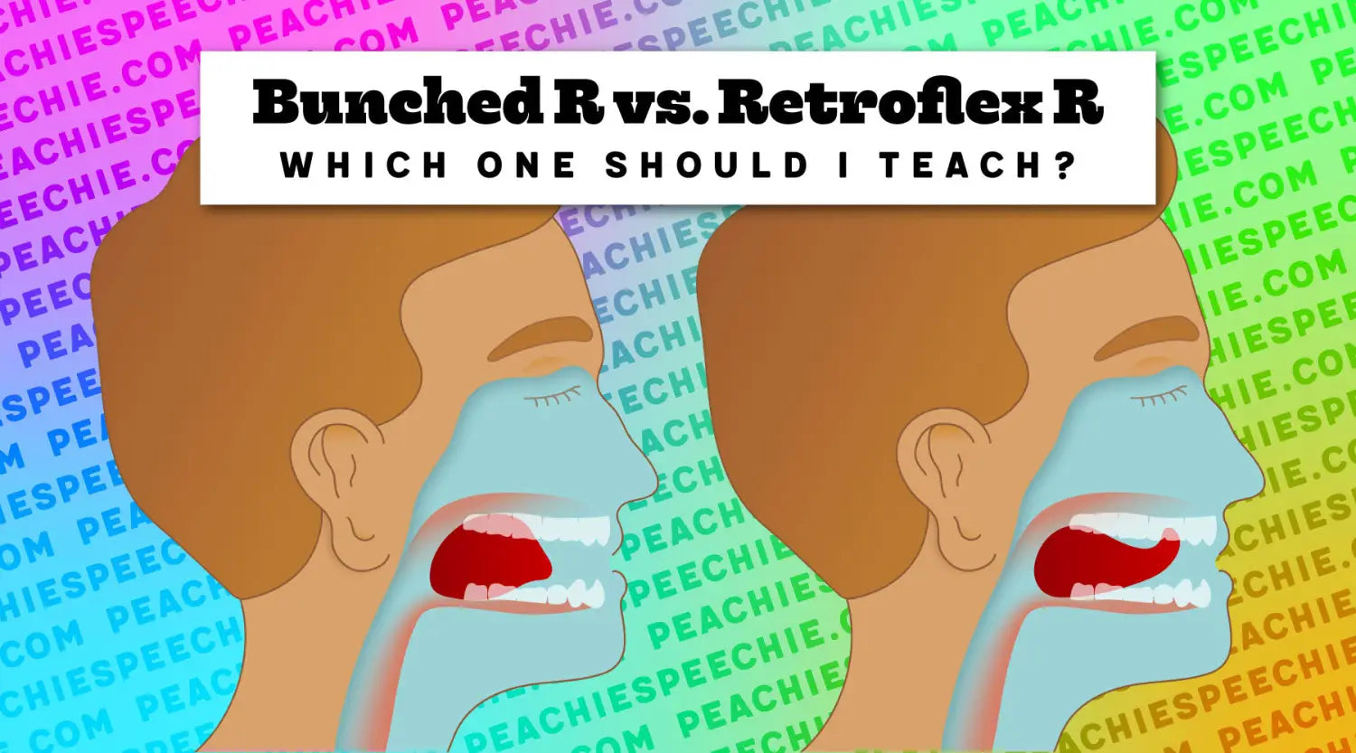 Bunched R vs. Retroflex R: Which one should I teach?